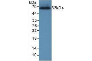 Detection of Recombinant CRHBP, Rat using Monoclonal Antibody to Corticotropin Releasing Hormone Binding Protein (CRHBP) (CRHBP 抗体  (AA 25-322))