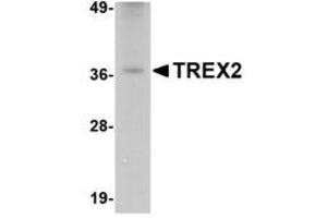 Image no. 1 for anti-three Prime Repair Exonuclease 2 (Trex2) (C-Term) antibody (ABIN341719) (TREX2 抗体  (C-Term))