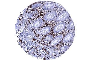 Intense CD56 immunostaining of nerve fibres in the appendix mucosa (Recombinant CD56 抗体)