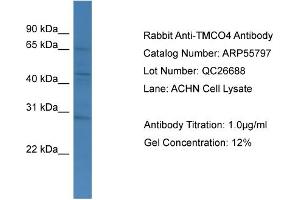 WB Suggested Anti-TMCO4  Antibody Titration: 0. (TMCO4 抗体  (C-Term))