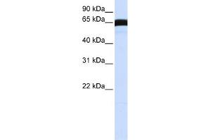Western Blotting (WB) image for anti-Polo-Like Kinase 1 (PLK1) (C-Term) antibody (ABIN2782496)