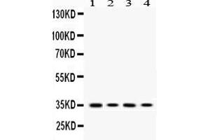 Western blot analysis of MC1 Receptor expression in PC12 whole cell lysates ( Lane 1), HEPA1-6 whole cell lysates ( Lane 2), HELA whole cell lysates ( Lane 3) and A375 whole cell lysates ( Lane 4). (MC1 Receptor 抗体  (C-Term))