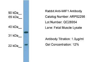 WB Suggested Anti-WIF1  Antibody Titration: 0. (WIF1 抗体  (N-Term))