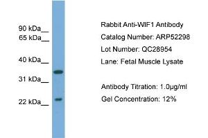 WB Suggested Anti-WIF1  Antibody Titration: 0. (WIF1 抗体  (N-Term))