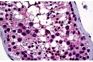Human Testis: Formalin-Fixed, Paraffin-Embedded (FFPE) (HDAC6 抗体  (AA 7-56))