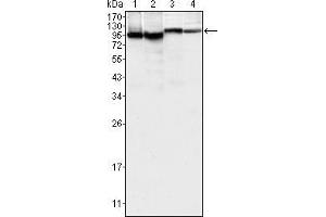 Western blot analysis using BTK mouse mAb against K562 (1), MCF-7 (2), Jurkat (3) and HEK293 (4) cell lysate. (BTK 抗体)