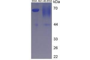 Image no. 2 for Amyloid beta 1-40 (Abeta 1-40) peptide (BSA) (ABIN5665936) (Amyloid beta 1-40 (Abeta 1-40) peptide (BSA))
