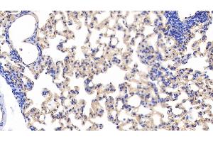 Detection of PODXL in Rat Lung Tissue using Polyclonal Antibody to Podocalyxin (PODXL) (PODXL 抗体  (AA 408-485))