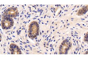 Immunohistochemistry (IHC) image for anti-Nuclear Factor kappa B (NFkB) (AA 352-439) antibody (ABIN7434143)