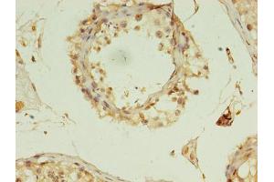 Immunohistochemistry of paraffin-embedded human testis tissue using ABIN7150974 at dilution of 1:100 (RANBP2 抗体  (AA 2601-2802))