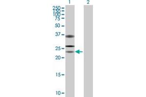 Western Blot analysis of USP53 expression in transfected 293T cell line by USP53 MaxPab polyclonal antibody. (USP53 抗体  (AA 1-188))