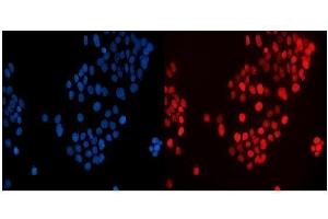 IF analysis of MAFF using anti-MAFF antibody (ABIN7599317).