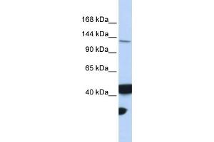 WB Suggested Anti-MLH3 Antibody Titration:  0. (MLH3 抗体  (Middle Region))