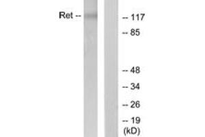 Western blot analysis of extracts from K562 cells, using Ret (Ab-1062) Antibody. (Ret Proto-Oncogene 抗体  (AA 1041-1090))