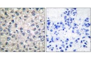 Immunohistochemistry (IHC) image for anti-Catenin (Cadherin-Associated Protein), alpha 1, 102kDa (CTNNA1) (AA 857-906) antibody (ABIN1533220)