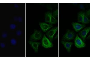 Immunofluorescence (IF) image for anti-Collagen, Type III, alpha 1 (COL3A1) (AA 1171-1435) antibody (ABIN7435409)