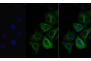 Detection of COL3a1 in Human Hela cell using Polyclonal Antibody to Collagen Type III Alpha 1 (COL3a1) (COL3A1 抗体  (AA 1171-1435))