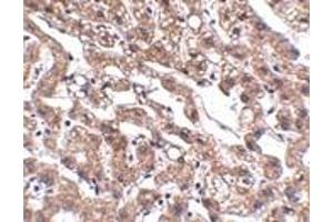 Immunohistochemistry (IHC) image for anti-Metastasis Associated in Colon Cancer 1 (MACC1) (Middle Region) antibody (ABIN1030992) (MACC1 抗体  (Middle Region))