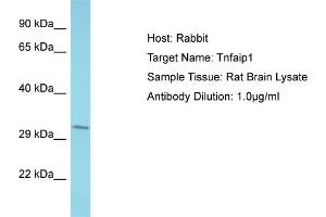 Host: Rabbit Target Name: Tnfaip1 Sample Type: Rat Brain lysates Antibody Dilution: 1. (TNFAIP1 抗体  (C-Term))