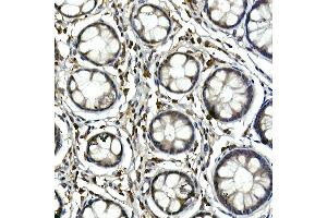 Immunohistochemistry of paraffin-embedded human colon using Tec Rabbit pAb (ABIN6128353, ABIN6148988, ABIN6148989 and ABIN6213654) at dilution of 1:100 (40x lens). (NR4A3 抗体  (AA 1-280))