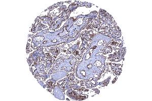 Placenta mature Strong CD141 staining of the surface cell layer of the cytotrophoblast and of endothelial cells CD141 immunohistochemistry. (Recombinant Thrombomodulin 抗体  (AA 69-194))