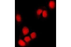Immunofluorescent analysis of RING1b staining in U2OS cells. (RNF2 抗体)
