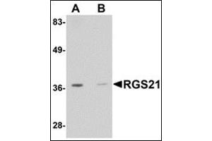 Western blot analysis: AP30716PU-N RGS21 antibody staining of HepG2 cell lysate at 0. (RGS21 抗体  (Center))
