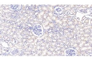Detection of PIGR in Bovine Kidney Tissue using Polyclonal Antibody to Polymeric Immunoglobulin Receptor (PIGR) (PIGR 抗体  (AA 461-560))