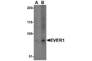 Western blot analysis of EVER1 in A-20 cell lysate with AP30321PU-N EVER1 antibody at (A) 1 and (B) 2 μg/ml. (TMC6 抗体  (N-Term))