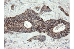 Image no. 11 for anti-Diphthamide Biosynthesis Protein 2 (DPH2) antibody (ABIN1497892)