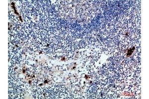 Immunohistochemical analysis of paraffin-embedded human-lymph, antibody was diluted at 1:200 (ZAP7 (AA 391-440) 抗体)