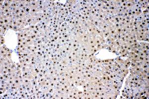 IHC analysis of ADK using anti- ADK antibody . (ADK 抗体  (AA 165-351))