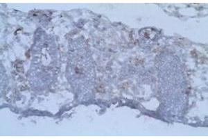Immunohistochemistry (IHC) image for anti-CD40 Ligand (CD40LG) antibody (ABIN1105904) (CD40 Ligand 抗体)