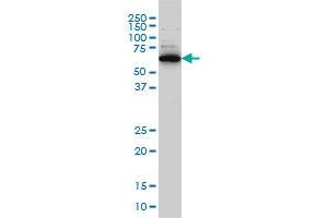 Western Blotting (WB) image for anti-E3 ubiquitin-protein ligase RAD18 (RAD18) (AA 332-430) antibody (ABIN566046)