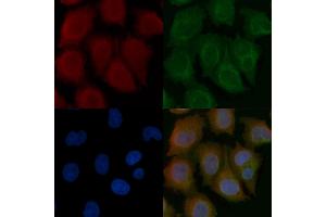 MURC Mouse Monoclonal Antibody staining Hela cells by IF/ICC. (MURC 抗体)