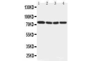 Anti-IRAK antibody, Western blotting Lane 1: Rat Liver Tissue Lysate Lane 2: Human Placenta Tissue Lysate Lane 3: MCF-7 Cell Lysate Lane 4: PANC Cell Lysate (IRAK1 抗体  (N-Term))