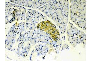 IHC analysis of IGFBP1 using anti-IGFBP1 antibody . (IGFBPI 抗体  (AA 26-272))
