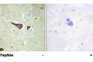 Immunohistochemical analysis of paraffin-embedded human brain tissue using IGF2R polyclonal antibody . (IGF2R 抗体)