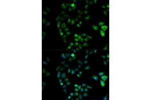 Immunofluorescence (IF) image for anti-Hydroxysteroid (17-Beta) Dehydrogenase 2 (HSD17B2) antibody (ABIN1873085) (HSD17B2 抗体)