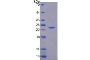 SDS-PAGE analysis of Human TNNI1 Protein. (TNNI1 蛋白)