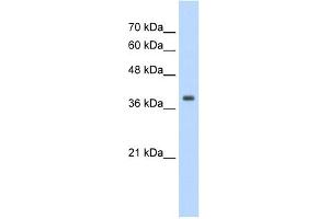 WB Suggested Anti-TPM1 Antibody Titration:  1. (Tropomyosin 抗体  (N-Term))