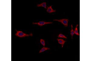 ABIN6264825 and ABIN6273015 staining HepG2 by IF/ICC. (RPGRIP1L 抗体  (N-Term))