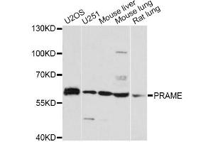 Western blot analysis of extracts of various cell lines, using PRAME antibody. (PRAME 抗体)