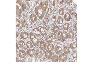 Immunohistochemical staining of human duodenum with ASCL3 polyclonal antibody  shows moderate cytoplasmic positivity in glandular cells at 1:20-1:50 dilution.