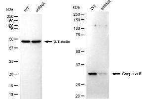 Western blotting analysis using caspase 6 antibody (ABIN7797900). (Recombinant Caspase 6 抗体)