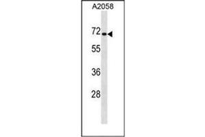 Western blot analysis of CPEB1 Antibody (C-term) in A2058 cell line lysates (35ug/lane). (CPEB1 抗体  (C-Term))