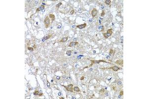 Immunohistochemistry of paraffin-embedded rat brain using OSGEPL1 antibody at dilution of 1:100 (x40 lens). (OSGEPL1 抗体)