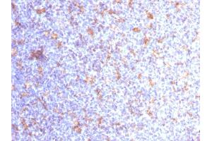 Formalin-fixed, paraffin-embedded human Tonsil stained with CD11c Mouse Monoclonal Antibody (ITGAX/1284). (CD11c 抗体  (AA 637-827))