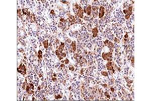 IHC testing of human pituitary gland stained with ACTH antibody (AH26). (ACTH 抗体  (AA 1-24))