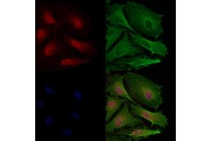 SGK1 Antibody staining A549 cells by IF/ICC. (SGK1 抗体)